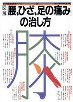 図解 腰、ひざ、足の痛みの治し方 -(目で見る家庭医学シリーズ8)