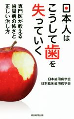 日本人はこうして歯を失っていく 専門医が教える歯周病の怖さと正しい治し方-