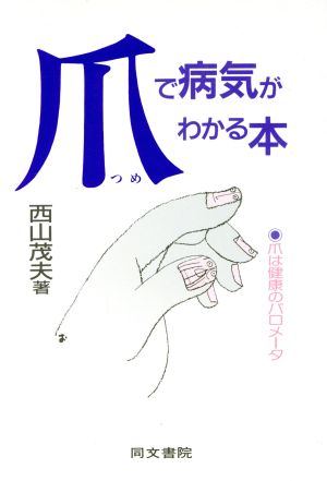 爪で病気がわかる本爪は健康のバロメータ 中古本 書籍 西山茂夫 著 ブックオフオンライン