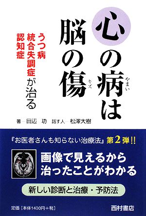 心の病は脳の傷うつ病 統合失調症 認知症が治る 中古本 書籍 田辺功 著 松澤大樹 話 ブックオフオンライン