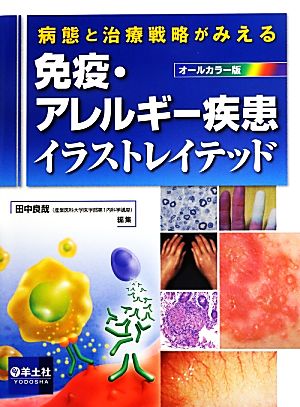 病態と治療戦略がみえる免疫 アレルギー疾患イラストレイテッド 中古本 書籍 田中良哉 編 ブックオフオンライン